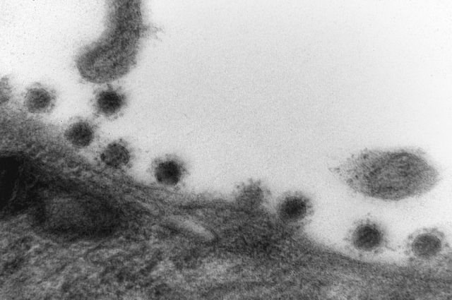opublikovany-pervye-foto-delta-shtamma-koronavirusa-19e6ddc