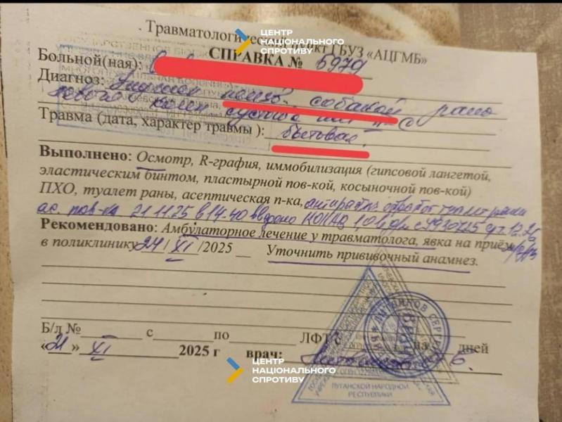 В Донецкой области растет количество нападений бродячих собак на людей, особенно на детей: в ЦНС назвали причину