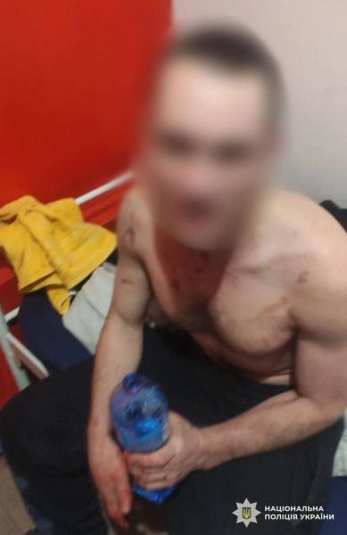 В Киеве мужчина бросил гранату в хостеле во время конфликта, ему грозит 15 лет тюрьмы